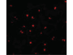 NOD2 Antibody in Immunocytochemistry (ICC/IF)