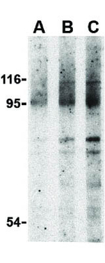 NOD2 Antibody in Western Blot (WB)
