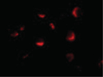 PID Antibody in Immunocytochemistry (ICC/IF)