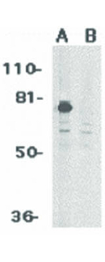 PID Antibody in Western Blot (WB)
