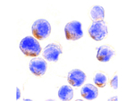 STAT1 alpha Polyclonal Antibody