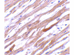 TIRAP Antibody in Immunohistochemistry (Paraffin) (IHC (P))
