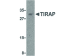 TIRAP Antibody in Western Blot (WB)