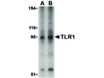 TLR1 Antibody in Western Blot (WB)