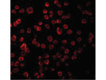 TLR11 Antibody in Immunocytochemistry (ICC/IF)
