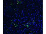 BAFF Antibody in Immunocytochemistry (ICC/IF)
