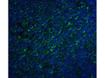 CCR5 Polyclonal Antibody