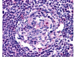 CCR5 Antibody in Immunohistochemistry (Paraffin) (IHC (P))