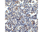 CCR5 Antibody in Immunohistochemistry (Paraffin) (IHC (P))