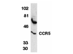 CCR5 Antibody in Western Blot (WB)