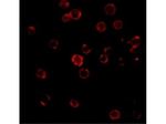 CXCR4 Antibody in Immunocytochemistry (ICC/IF)