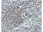 CXCR4 Antibody in Immunohistochemistry (Paraffin) (IHC (P))