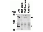 CXCR4 Antibody in Western Blot (WB)