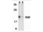 PERP Antibody in Western Blot (WB)