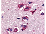 Trail Antibody in Immunohistochemistry (Paraffin) (IHC (P))