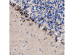 DR5 Antibody in Immunohistochemistry (Paraffin) (IHC (P))