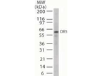 DR5 Antibody in Western Blot (WB)