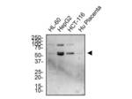 DR5 Antibody in Western Blot (WB)
