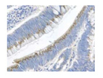 Gremlin Polyclonal Antibody