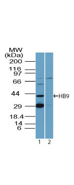 HB9 Antibody in Western Blot (WB)