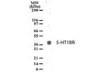 Serotonin Receptor 1B Polyclonal Antibody