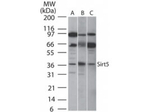 SIRT5 Polyclonal Antibody