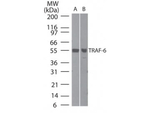 TRAF6 Polyclonal Antibody