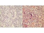 Wnt5A Polyclonal Antibody