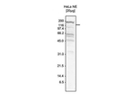 SKI3 Antibody in Western Blot (WB)