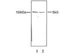 SKI3 Antibody in Western Blot (WB)