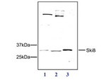 SKI8 Polyclonal Antibody