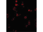AATF Polyclonal Antibody