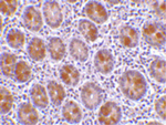 AATF Antibody in Immunohistochemistry (Paraffin) (IHC (P))
