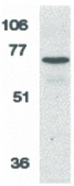 AIF Antibody in Western Blot (WB)
