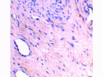 ARMER Antibody in Immunohistochemistry (Paraffin) (IHC (P))