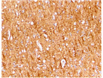 ATR Antibody in Immunohistochemistry (Paraffin) (IHC (P))