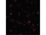 ATR Antibody in Immunocytochemistry (ICC/IF)