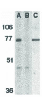 BACE Antibody in Western Blot (WB)