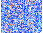 BAD Antibody in Immunohistochemistry (Paraffin) (IHC (P))