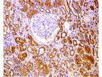 BCL2 Antibody in Immunohistochemistry (Paraffin) (IHC (P))
