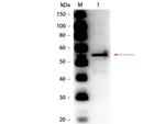Aldehyde Dehydrogenase Polyclonal Antibody, HRP