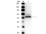 Hexokinase Polyclonal Antibody, HRP