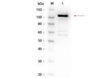 beta Galactosidase Antibody in Western Blot (WB)