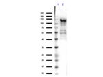 beta Galactosidase Antibody in Western Blot (WB)