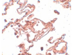 CCDC69 Antibody in Immunohistochemistry (Paraffin) (IHC (P))