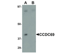 CCDC69 Antibody in Western Blot (WB)