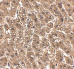 erbB-2 Antibody in Immunohistochemistry (Paraffin) (IHC (P))