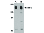 erbB-2 Antibody in Western Blot (WB)
