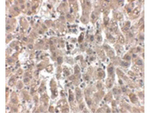 LDL-R Antibody in Immunohistochemistry (Paraffin) (IHC (P))