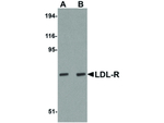 LDL-R Antibody in Western Blot (WB)